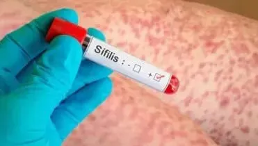 SIFILIS