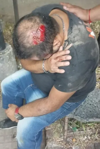 El hombre fue lesionado de un golpe en la cabeza durante un hecho de inseguridad.