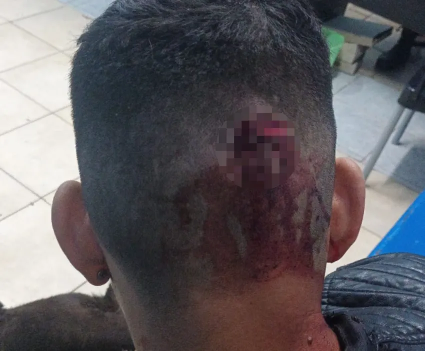 Joven herido en la cabeza
