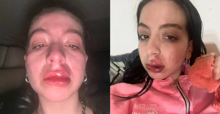 Cecilia Gayupán denunció el ataque.